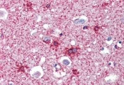Immunohistochemistry-Paraffin: Septin-2 Antibody [NBP1-06076] - Staining of paraffin embedded Human Cortex. Antibody at 2.5 ug/mL. Steamed antigen retrieval with citrate buffer pH 6, AP-staining.