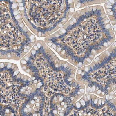 Immunohistochemistry-Paraffin: Septin-2 Antibody [NBP1-85212] - Staining of human small intestine shows weak cytoplasmic positivity in glandular cells.
