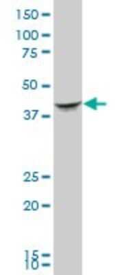 Western Blot: Septin-2 Antibody [H00004735-B01P] - Analysis of SEPT2 expression in human spleen.
