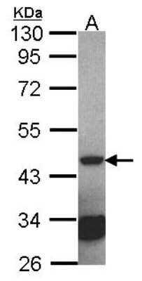 Western Blot: Septin-2 Antibody [NBP1-31496] - Sample (30 ug of whole cell lysate) A: NT2D1 10% SDS PAGE, antibody diluted at 1:2000.