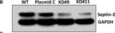 <b>Genetic Strategies Validation. </b>Western Blot: Septin-2 Antibody [NBP1-85212] - Stable septin-2 knockdown shows a decrease in proliferation. Verification of septin-2 knockdown at protein level visualized by Western blot. A single blot was probed simultaneously for septin-2 and GAPDH as a loading control. The original blot can be seen in Supplementary Figure 4. Image collected and cropped by CiteAb from the following publication (//www.oncotarget.com/lookup/doi/10.18632/oncotarget.26836), licensed under a CC-BY license.