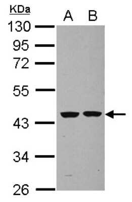 Western Blot: Septin-2 Antibody [NBP2-20301] - Sample (30 ug of whole cell lysate) A: U87-MG B: SK-N-SH 10% SDS PAGE gel, diluted at 1:1000.