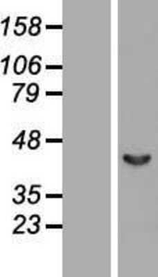 Western Blot: Septin-2 Overexpression Lysate (Adult Normal) [NBP2-10989] Left-Empty vector transfected control cell lysate (HEK293 cell lysate); Right -Over-expression Lysate for Septin-2.