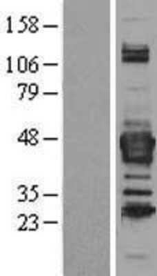 Western Blot: Septin-3 Overexpression Lysate (Adult Normal) [NBL1-07141] Left-Empty vector transfected control cell lysate (HEK293 cell lysate); Right -Over-expression Lysate for Septin-3.