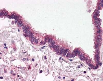 Immunohistochemistry-Paraffin: Septin-4 Antibody [NBP1-02711] - Staining of human lung, respiratory epithelium. Immunohistochemistry of formalin-fixed, paraffin-embedded tissue after heat-induced antigen retrieval. Antibody concentration 5 ug/ml.