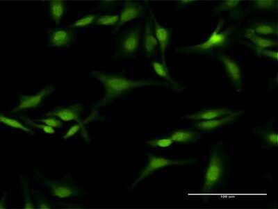 Immunocytochemistry/Immunofluorescence: Septin-5 Antibody [H00005413-D01P] - Analysis of antibody to SEPT5 on HeLa cell. Antibody concentration 20 ug/ml.
