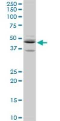 Western Blot: Septin-5 Antibody [H00005413-D01P] - Analysis of SEPT5 expression in HeLa.