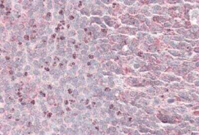 Immunohistochemistry-Paraffin: Septin-6 Antibody [NBP1-51930] - Staining of paraffin embedded Human Tonsil. Antibody at 3.8 ug/mL. Steamed antigen retrieval with citrate buffer pH 6, AP-staining.