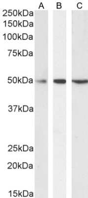 Western Blot: Septin-6 Antibody [NBP1-51930] - Staining (0.1ug/ml) of Daudi (A), Jurkat (B) and MOLT4 (C) cell lysate (35ug protein in RIPA buffer). Detected by chemiluminescence.