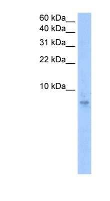 Western Blot: Septin-6 Antibody [NBP1-52840] - Jurkat cell lysate, concentration 0.2-1 ug/ml.