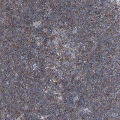 Immunohistochemistry-Paraffin: Septin-7 Antibody [NBP1-85730] - Staining of human lymph node shows moderate cytoplasmic positivity in lymphoid cells.