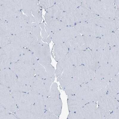 Immunohistochemistry-Paraffin: Septin-7 Antibody [NBP1-85730] - Staining of human skeletal muscle shows no positivity in myocytes as expected.