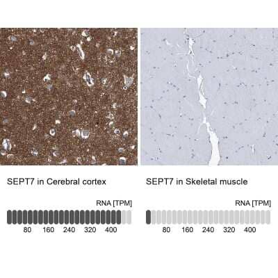 Immunohistochemistry-Paraffin: Septin-7 Antibody [NBP1-85730] - Staining in human cerebral cortex and skeletal muscle tissues . Corresponding SEPT7 RNA-seq data are presented for the same tissues.