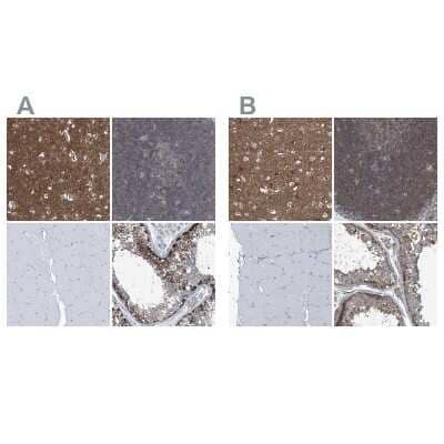 <b>Independent Antibodies Validation and Orthogonal Strategies Validation.</b>Immunohistochemistry-Paraffin: Septin-7 Antibody [NBP1-85730] - Staining of human cerebral cortex, lymph node, skeletal muscle and testis using Anti-SEPT7 antibody NBP1-85730 (A) shows similar protein distribution across tissues to independent antibody NBP1-85731 (B).