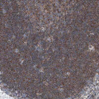 Immunohistochemistry-Paraffin: Septin-7 Antibody [NBP1-85731] - Staining of human lymph node shows moderate cytoplasmic positivity in non-germinal center cells.