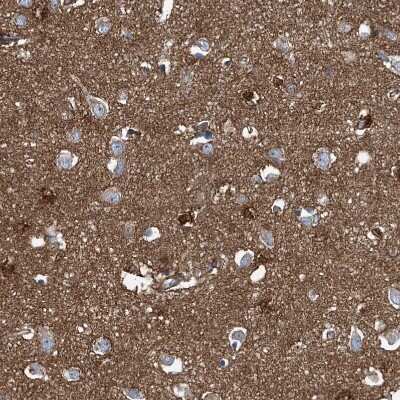 Immunohistochemistry-Paraffin: Septin-7 Antibody [NBP1-85731] - Staining of human cerebral cortex shows strong cytoplasmic positivity in neuropil.