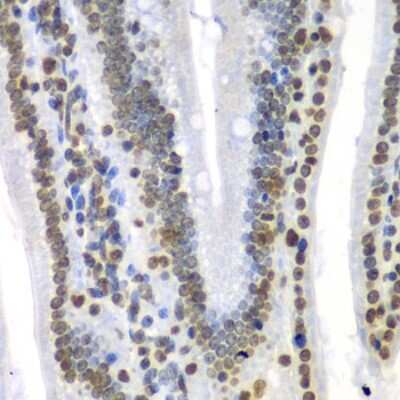 Immunohistochemistry-Paraffin: Septin-7 Antibody [NBP2-95090] - Paraffin-embedded mouse Intestine using Septin-7 .