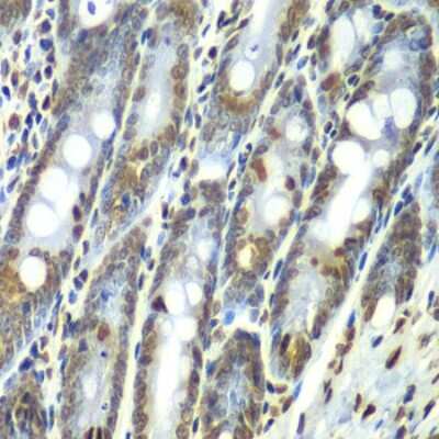 Immunohistochemistry-Paraffin: Septin-7 Antibody [NBP3-03670] - Paraffin-embedded rat Intestine using Septin-7 antibody at dilution of 1:100 (40x lens).
