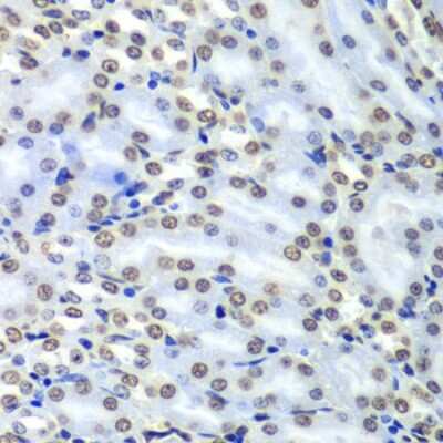 Immunohistochemistry-Paraffin: Septin-7 Antibody [NBP3-03670] - Paraffin-embedded mouse kidney using Septin-7 antibody at dilution of 1:100 (40x lens).