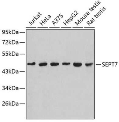 Immunohistochemistry-Paraffin Septin-7 Antibody - BSA Free