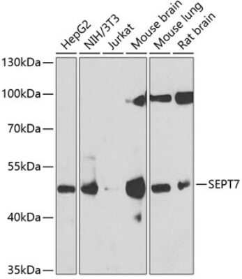 Western Blot: Septin-7 Antibody [NBP2-95090] - Analysis of extracts of various cell lines, using Septin-7 at 1:1000 dilution. Secondary antibody: HRP Goat Anti-Rabbit IgG (H+L) at 1:10000 dilution. Lysates/proteins: 25ug per lane. Blocking buffer: 3% nonfat dry milk in TBST. Detection: ECL Basic Kit . Exposure time: 30s.