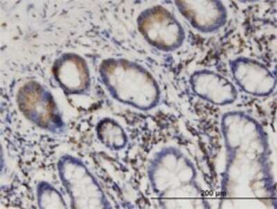 Immunohistochemistry-Paraffin: Septin-8 Antibody (1G3-7D1) [H00023176-M01] - Analysis of monoclonal antibody to SEPT8 on formalin-fixed paraffin-embedded human small Intestine. Antibody concentration 3 ug/ml.