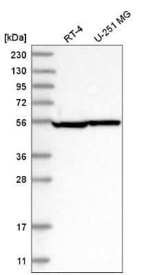 Western Blot: Septin-8 Antibody [NBP2-76533] - Analysis in human cell line RT-4 and human cell line U-251 MG.