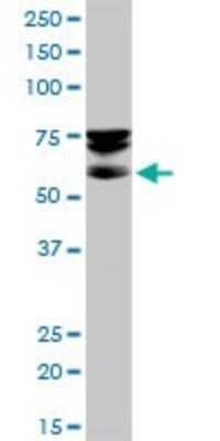 Western Blot: Septin-9 Antibody [H00010801-B01P] - Analysis of SEPT9 expression in HepG2.