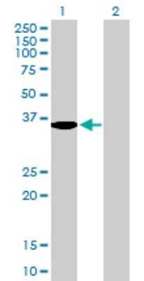 Western Blot: Serine Dehydratase Antibody [H00010993-B01P] - Analysis of SDS expression in transfected 293T cell line by SDS polyclonal antibody.  Lane 1: SDS transfected lysate(36.08 KDa). Lane 2: Non-transfected lysate.