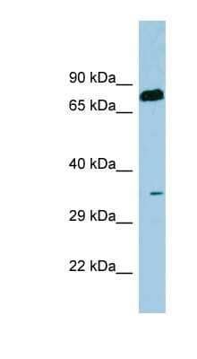 Western Blot: Serine Dehydratase Antibody [NBP1-56667] - Human Thymus lysate, concentration 0.2-1 ug/ml.