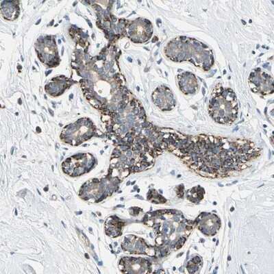 Immunohistochemistry-Paraffin: Serine/threonine-protein kinase NIM1 Antibody [NBP2-14254] - Staining of human breast shows distinct cytoplasmic positivity in myoepithelium.