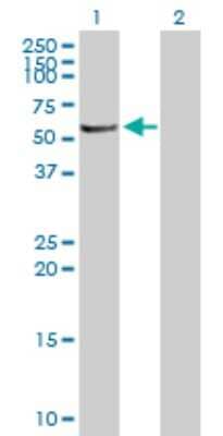 Western Blot Serine/threonine-protein kinase NIM1 Antibody - Azide and BSA Free