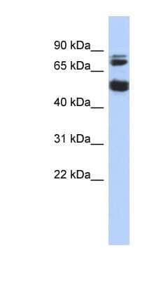 Western Blot Serine/threonine-protein kinase NIM1 Antibody - BSA Free