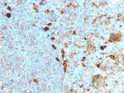 Immunohistochemistry-Paraffin: Serpin A1/alpha 1-Antitrypsin Antibody (AAT/1378) [NBP2-48476] - Analysis of human Tonsil stained with  Alpha-1-Antitrypsin Monoclonal Antibody (AAT/1378).