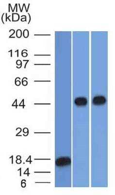 Western Blot: Serpin A1/alpha 1-Antitrypsin Antibody (AAT/1378) [NBP2-48476] - Analysis of recombinant Alpha-1-Antitrypsin, Jurkat and A549 Cell Lysate using Alpha-1-Antitrypsin Monoclonal Antibody (AAT/1378).