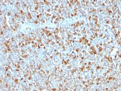 Immunohistochemistry-Paraffin: Serpin A1/alpha 1-Antitrypsin Antibody (AAT/1379) [NBP2-54442] - Formalin-fixed, paraffin-embedded human Tonsil stained with Alpha-1-Antitrypsin Monoclonal Antibody (AAT/1379)