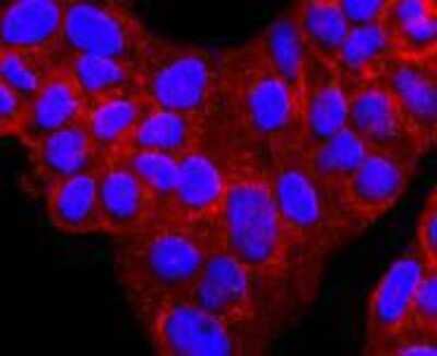Immunocytochemistry/Immunofluorescence: Serpin A1/alpha 1-Antitrypsin Antibody (JF10-03) [NBP2-67135] - Staining alpha 1 Antitrypsin in Hela cells (red). The nuclear counter stain is DAPI (blue). Cells were fixed in paraformaldehyde, permeabilised with 0.25% Triton X100/PBS.