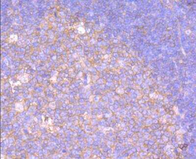 Immunohistochemistry-Paraffin: Serpin A1/alpha 1-Antitrypsin Antibody (JF10-03) [NBP2-67135] - Analysis of paraffin-embedded human spleen tissue using anti-alpha 1 Antitrypsin antibody. Counter stained with hematoxylin.