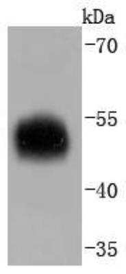 Western Blot: Serpin A1/alpha 1-Antitrypsin Antibody (JF10-03) [NBP2-67135] - Analysis of alpha 1 Antitrypsin on human spleen lysates using anti-alpha 1 Antitrypsin antibody