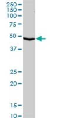 Western Blot: Serpin A10/ZPI Antibody [H00051156-D01P] - Analysis of SERPINA10 expression in human kidney.