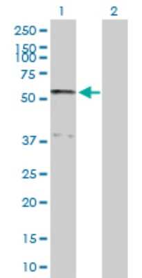 Western Blot: Serpin A10/ZPI Antibody [H00051156-D01P] - Analysis of SERPINA10 expression in transfected 293T cell line by SERPINA10 polyclonal antibody.Lane 1: SERPINA10 transfected lysate(50.70 KDa).Lane 2: Non-transfected lysate.