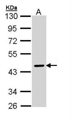 Western Blot: Serpin A10/ZPI Antibody [NBP1-32903] - Sample (30 ug of whole cell lysate) A: Molt-4 10% SDS PAGE, antibody diluted at 1:3000.