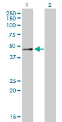Western Blot: Serpin A12 Antibody [H00145264-D01P] - Analysis of SERPINA12 expression in transfected 293T cell line by SERPINA12 polyclonal antibody.Lane 1: SERPINA12 transfected lysate(47.20 KDa).Lane 2: Non-transfected lysate.