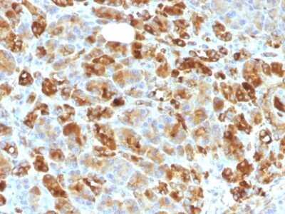 Immunohistochemistry-Paraffin: Serpin A3/alpha 1-Antichymotrypsin Antibody (AACT/1451 + AACT/1452) [NBP2-53320]