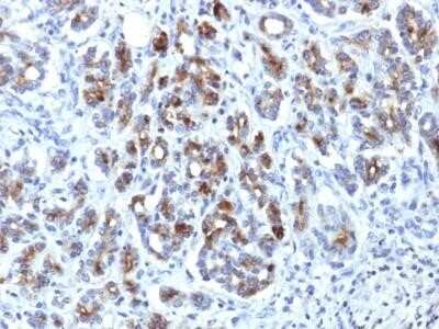 Immunohistochemistry-Paraffin: Serpin A3/alpha 1-Antichymotrypsin Antibody (AACT/1451) - Azide and BSA Free [NBP2-54339] - human pancreas stained with  Alpha-1-Antichymotrypsin Monoclonal Antibody