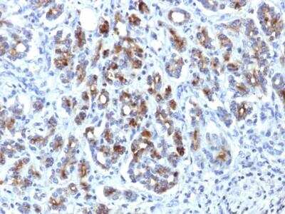 Immunohistochemistry-Paraffin: Serpin A3/alpha 1-Antichymotrypsin Antibody (AACT/1451) [NBP2-53316] - Human Pancreas stained with  Alpha-1-Antichymotrypsin Monoclonal Antibody (AACT/1451)