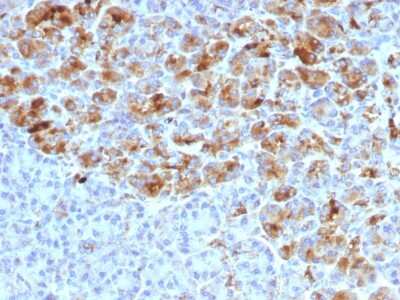 Immunohistochemistry-Paraffin: Serpin A3/alpha 1-Antichymotrypsin Antibody (AACT/1452) [NBP2-54438]