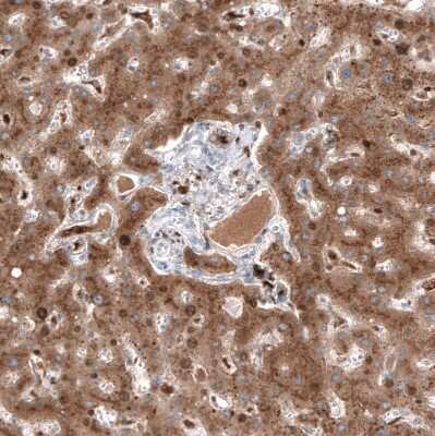 Immunohistochemistry-Paraffin: Serpin A3/alpha 1-Antichymotrypsin Antibody (CL10697) [NBP3-07987] - Staining of human liver shows strong cytoplasmic positivity in hepatocytes.