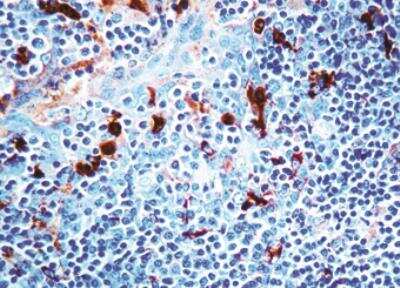 Immunohistochemistry-Paraffin: Serpin A3/alpha 1-Antichymotrypsin Antibody [NB120-9374] - Formalin fixed paraffin embedded human tonsil stained with alpha-1-Antichymotrypsin antibody (NB120-9374).