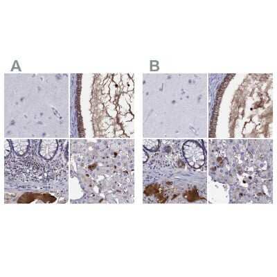 <b>Independent Antibodies Validation. </b>Immunohistochemistry-Paraffin: Serpin A3/alpha 1-Antichymotrypsin Antibody [NBP1-90295] - Staining of human cerebral cortex, cervix, uterine, colon and liver using Anti-SERPINA3 antibody NBP1-90295 (A) shows similar protein distribution across tissues to independent antibody NBP1-90296 (B).